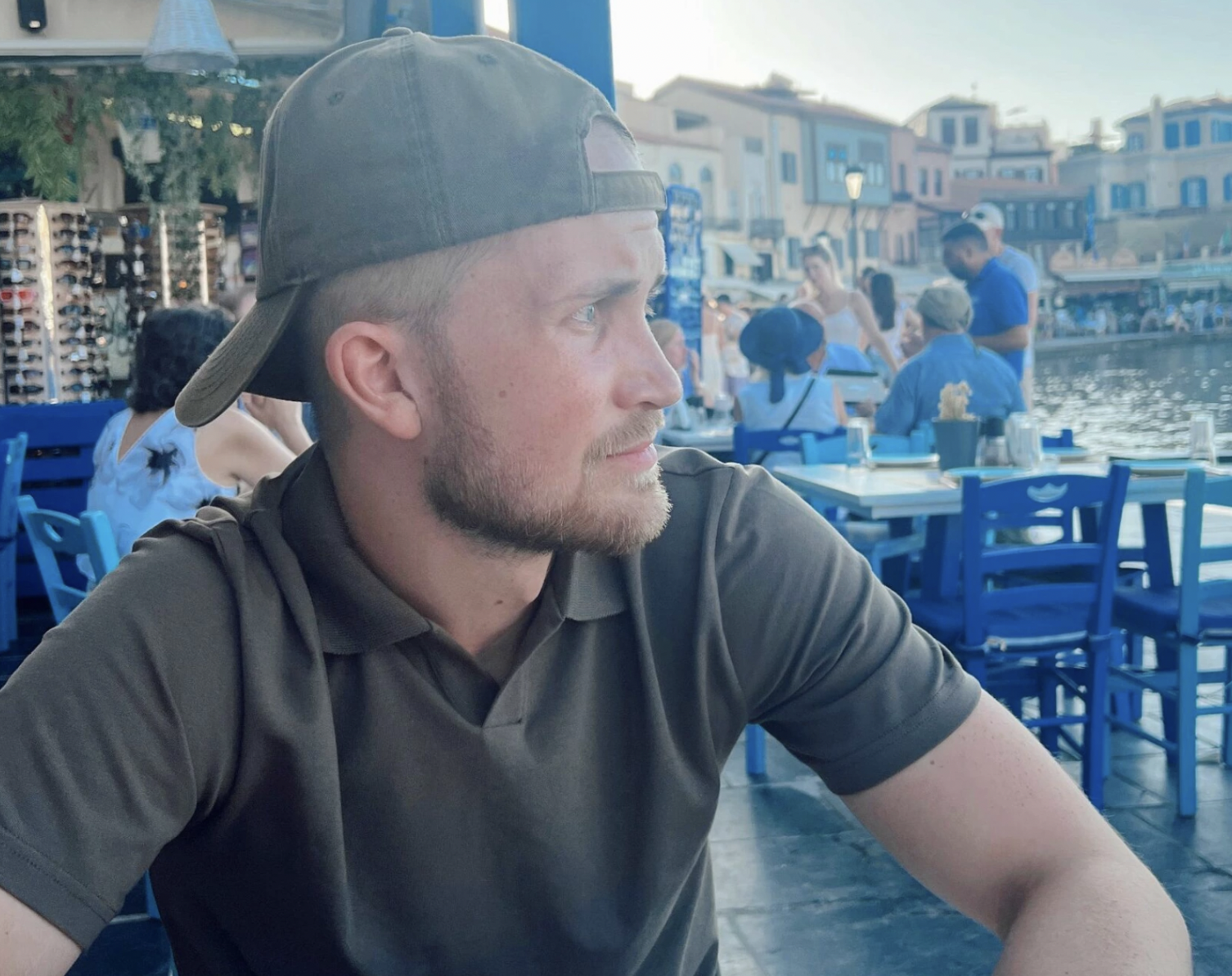 Askil mistet håret som tenåring